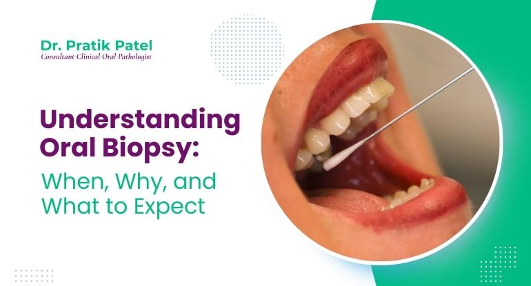 Understanding Oral Biopsy: When, Why, and What to Expect